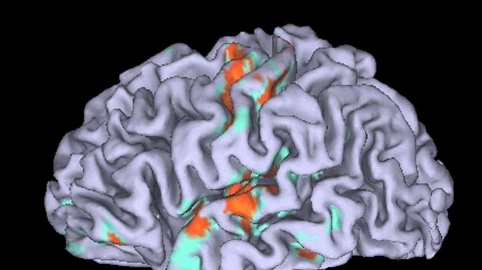Le risate spontanee e quelle volontarie nascono in zone diverse del cervello
