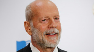 L'acteur Bruce Willis souffre d'une forme de d&eacute;mence incurable