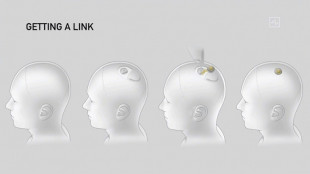 Musk dice que su empresa Neuralink instal&oacute; un implante cerebral en su primer paciente