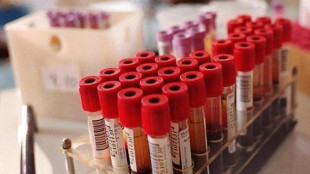 Per 9 italiani su 10 la scienza medica &egrave; motore sviluppo