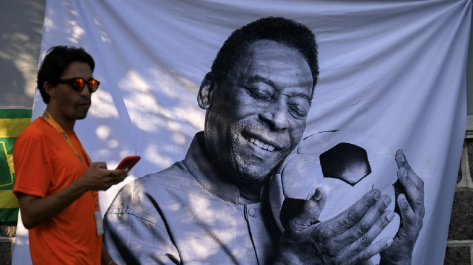 M&aacute;s de 700 "Pel&eacute;" nacieron en Per&uacute; en 2022