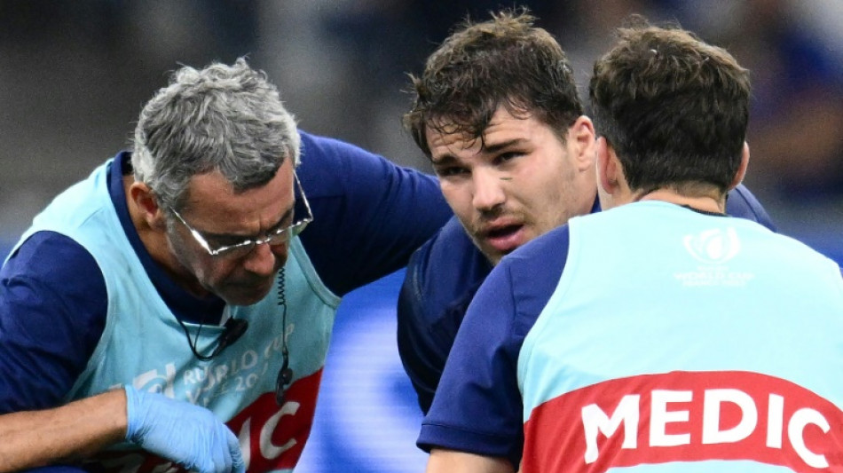 Mondial-2023: les Bleus dans l'adversit&eacute;