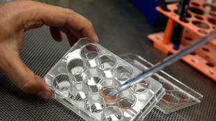 IA per biomedicina, all'Università Torino i primi laureati