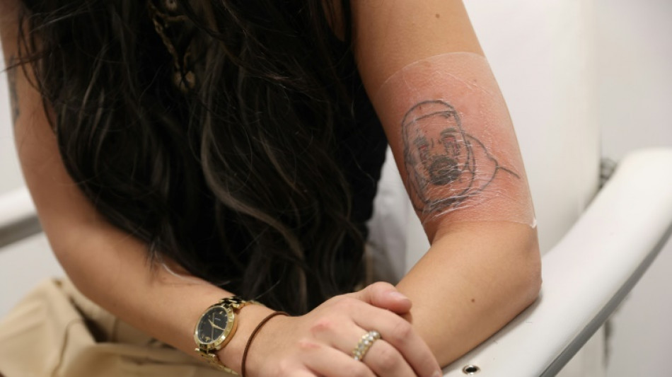 Estudio brit&aacute;nico ayuda a exfans de Kanye West a quitarse sus tatuajes